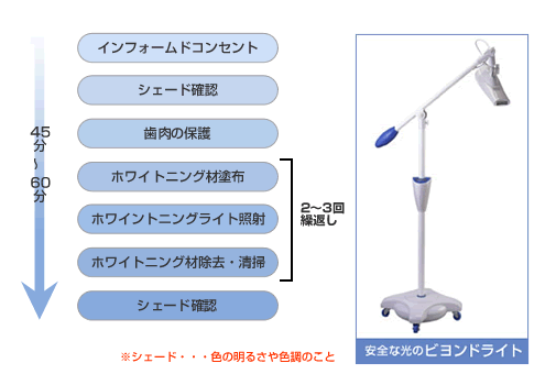 ビヨンドシステムのオフィスホワイトニングの手順